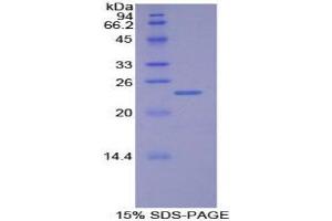 SDS-PAGE (SDS) image for Guanine Nucleotide Binding Protein (G Protein), beta Polypeptide 1-Like (GNB1L) (AA 69-247) protein (His tag) (ABIN2124893) (GNB1L Protein (AA 69-247) (His tag))