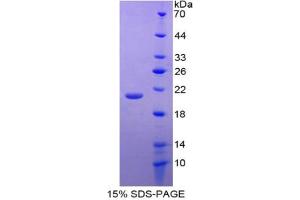 SDS-PAGE analysis of Mouse GDF2 Protein. (GDF2 Protein)