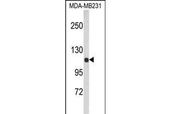 ACTN1 antibody  (N-Term)
