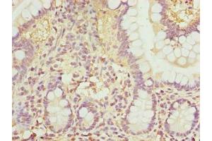 Immunohistochemistry of paraffin-embedded human small intestine tissue using ABIN7168034 at dilution of 1:100 (RhoF antibody  (AA 1-170))