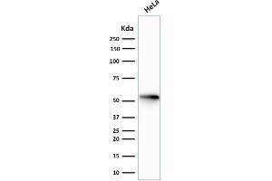 Western Blotting (WB) image for anti-Keratin 7 (KRT7) antibody (ABIN6939869)