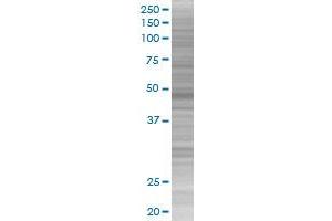 KRT16 transfected lysate. (KRT16 293T Cell Transient Overexpression Lysate(Denatured))