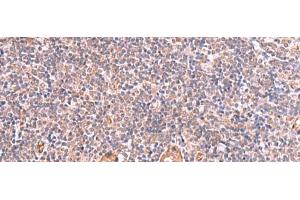 Immunohistochemistry of paraffin-embedded Human tonsil tissue using LMCD1 Polyclonal Antibody at dilution of 1:100(x200) (LMCD1 antibody)