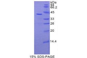 SDS-PAGE (SDS) image for Bone Morphogenetic Protein 10 (BMP10) (AA 314-421) protein (His tag,GST tag) (ABIN2122495) (BMP10 Protein (AA 314-421) (His tag,GST tag))