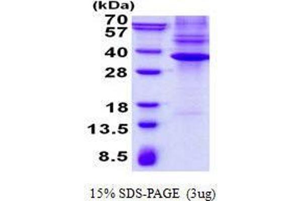 NKX3-1 Protein