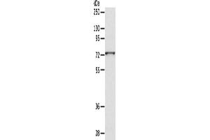 Western Blotting (WB) image for anti-ADAM Metallopeptidase Domain 10 (ADAM10) antibody (ABIN2429029) (ADAM10 antibody)