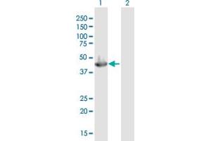 Western Blot analysis of SERPINB3 expression in transfected 293T cell line by SERPINB3 MaxPab polyclonal antibody. (SERPINB3 antibody  (AA 1-390))