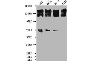 Western Blot Positive WB detected in: L02 whole cell lysate, Hela whole cell lysate, PC-3 whole cell lysate, A549 whole cell lysate All lanes: EGFR antibody at 1:2000 Secondary Goat polyclonal to rabbit IgG at 1/50000 dilution Predicted band size: 135, 45, 78, 70 kDa Observed band size: 165 kDa (Recombinant EGFR antibody)