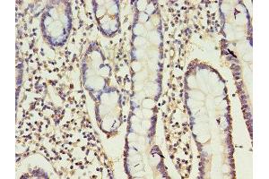 Immunohistochemistry of paraffin-embedded human small intestine tissue using ABIN7147118 at dilution of 1:100 (CD16 antibody  (AA 27-159))