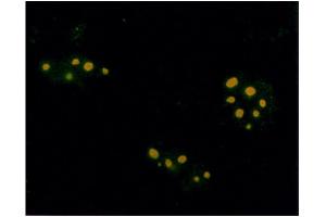 Immunofluorescence assay using anti-Farnesyl antibody on plasmids encoding isoprenylated protein and visualized using FITC- conjugated goat anti-rabbit antibody. (Farnesyl antibody)