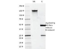 SDS-PAGE Analysis Purified CD7 Mouse Monoclonal Antibody (124-1D1). (CD7 antibody)