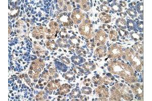 Image no. 1 for anti-Pre-B-Cell Leukemia Transcription Factor 3 (PBX3) (N-Term) antibody (ABIN203364) (PBX3 antibody  (N-Term))