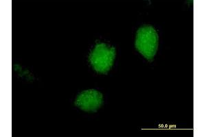 Immunofluorescence of purified MaxPab antibody to RARRES3 on HeLa cell. (RARRES3 antibody  (AA 1-164))