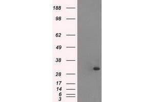 HEK293T cells were transfected with the pCMV6-ENTRY control (Left lane) or pCMV6-ENTRY TNNI3 (Right lane) cDNA for 48 hrs and lysed. (TNNI3 antibody  (AA 1-210))