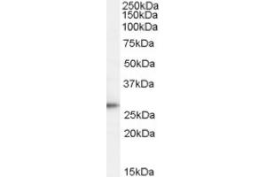 Image no. 1 for anti-Tumor Protein D52 (TPD52) (C-Term) antibody (ABIN375255) (TPD52 antibody  (C-Term))