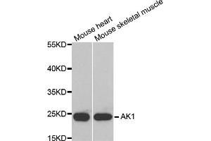 Western blot analysis of extracts of various cell lines, using AK1 antibody (ABIN5970560) at 1/1000 dilution. (Adenylate Kinase 1 antibody)
