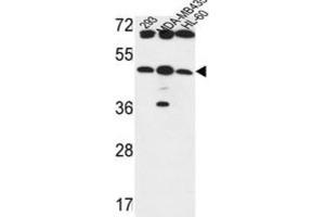 Western Blotting (WB) image for anti-UDP-GlcNAc:betaGal beta-1,3-N-Acetylglucosaminyltransferase 5 (B3GNT5) antibody (ABIN3004261) (B3GNT5 antibody)