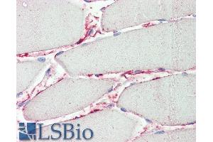 ABIN5539462 (5µg/ml) staining of paraffin embedded Human Skeletal Muscle. (PI15 antibody  (AA 128-141))