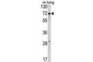 Western Blotting (WB) image for anti-Fragile X Mental Retardation 1 (FMR1) antibody (ABIN3002852) (FMR1 antibody)