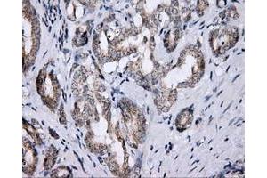 Immunohistochemistry (IHC) image for anti-Lipase, Endothelial (LIPG) antibody (ABIN1499170) (LIPG antibody)