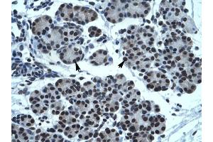 TPTE antibody was used for immunohistochemistry at a concentration of 4-8 ug/ml to stain Epithelial cells of pancreatic acinus (arrows) in Human Pancreas. (TPTE antibody  (C-Term))