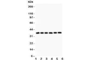 Western blot testing of Crk antibody and Lane 1:  rat spleen;  2: (r) thymus;  3: (r) liver;  4: mouse brain;  5: human HeLa;  6: (h) SMMC-7721 lysate. (Crk antibody  (AA 2-246))