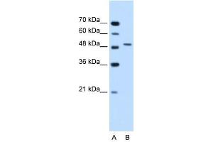 Semenogelin I antibody used at 1. (SEMG1 antibody  (N-Term))