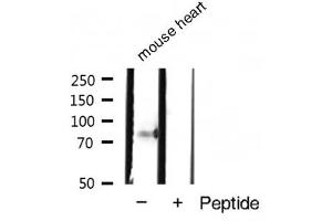 Western blot analysis of Phospho-STAT4 (Tyr693) expression in Mouse heart tissue lysate (STAT4 antibody  (pTyr693))