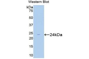 Detection of Recombinant Smad2, Mouse using Polyclonal Antibody to Mothers Against Decapentaplegic Homolog 2 (Smad2) (SMAD2 antibody  (AA 272-467))