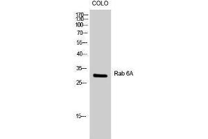 Western Blotting (WB) image for anti-RAB6A, Member RAS Oncogene Family (RAB6A) (Internal Region) antibody (ABIN3177078) (RAB6A antibody  (Internal Region))