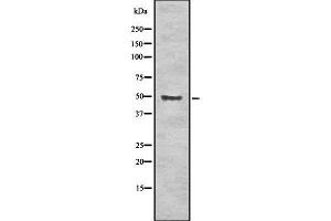 Western blot analysis of ALDH3A1 using K562 whole cell lysates (ALDH3A1 antibody  (C-Term))