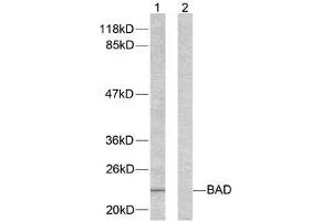 Western blot analysis of extracts from 293 cells using BAD (Ab-155) antibody (E021064). (BAD antibody)