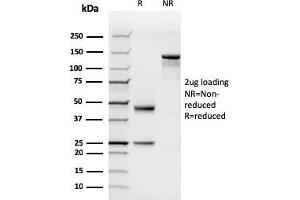 SDS-PAGE Analysis Purified N-Cadherin Recombinant Mouse Monoclonal Antibody (rCDH2/1426). (Recombinant N-Cadherin antibody)