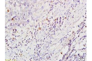 Immunohistochemistry (Paraffin-embedded Sections) (IHC (p)) image for anti-CD86 (CD86) (AA 140-175) antibody (ABIN736701)