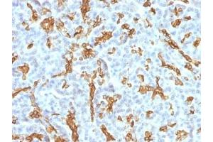 Immunohistochemistry (Formalin-fixed Paraffin-embedded Sections) (IHC (fp)) image for anti-Keratin 19 (KRT19) antibody (ABIN3025850)