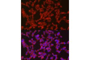 Immunofluorescence analysis of SH-SY5Y cells using Ret Rabbit pAb (ABIN6130657, ABIN6146873, ABIN6146874 and ABIN6213585) at dilution of 1:50 (40x lens). (Ret Proto-Oncogene antibody  (AA 29-300))