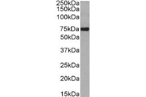 Western Blot using anti-CD36 antibody 185-1G2 (B467). (Recombinant CD36 antibody)