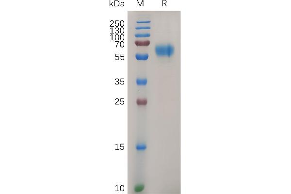 DDR1 Protein (AA 21-416) (His tag)