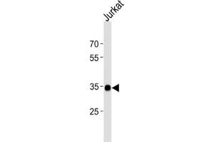 Western Blotting (WB) image for anti-SRY (Sex Determining Region Y)-Box 18 (SOX18) antibody (ABIN2998551) (SOX18 antibody)