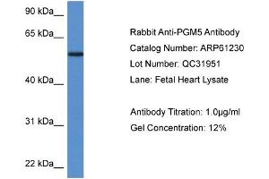 Western Blotting (WB) image for anti-Phosphoglucomutase 5 (PGM5) (N-Term) antibody (ABIN2788729) (Phosphoglucomutase 5 antibody  (N-Term))