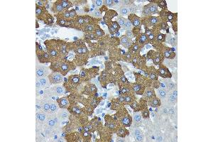 Immunohistochemistry of paraffin-embedded mouse liver using Argonaute-2 antibody (ABIN7265671) at dilution of 1:100 (40x lens). (AGO2 antibody)