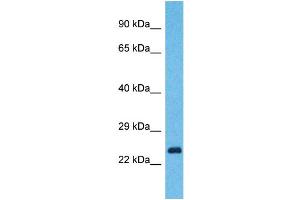 Western Blotting (WB) image for anti-Yip1 Domain Family, Member 7 (YIPF7) (N-Term) antibody (ABIN2501255) (YIPF7 antibody  (N-Term))