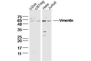 Lane 1: U2OS Cell lysates; Lane 2: U87MG Cell lysates; Lane 3: HeLa lysates; Lane 4: Jurkat lysates; probed with Vimentin Polyclonal Antibody, unconjugated (bs-23063R) at 1:300 overnight at 4°C followed by a conjugated secondary antibody for 60 minutes at 37°C. (Vimentin antibody  (AA 101-200))