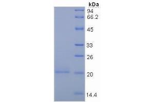 SDS-PAGE analysis of Human Mucin 5AC Protein. (MUC5AC Protein)