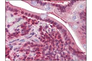 Human Small Intestine (formalin-fixed, paraffin-embedded) stained with PPP4Cfollowed by biotinylated secondary antibody, alkaline phosphatase-streptavidin and chromogen. (PPP4C antibody  (C-Term))