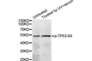 Western Blotting (WB) image for anti-Tumor Protein P53 (TP53) (pSer9) antibody (ABIN1870676) (p53 antibody  (pSer9))