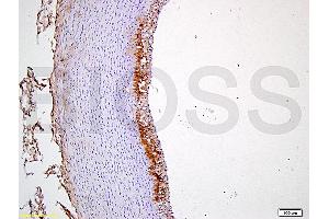 Formalin-fixed and paraffin embedded rabbit carotid artery tissue labeled with Anti-CD54/ICAM-1 Polyclonal Antibody, Unconjugated (ABIN707606) at 1:400 followed by conjugation to the secondary antibody and DAB staining (ICAM1 antibody  (AA 451-505))