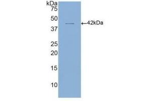 Detection of Recombinant CD4, Human using Polyclonal Antibody to Cluster Of Differentiation 4 (CD4) (CD4 antibody  (AA 26-390))