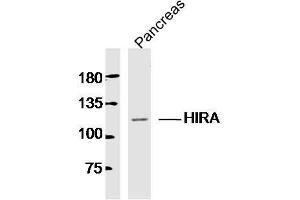 Mouse pancreas lysates probed with HIRA Polyclonal Antibody, Unconjugated  at 1:300 dilution and 4˚C overnight incubation. (HIRA antibody  (AA 251-350))