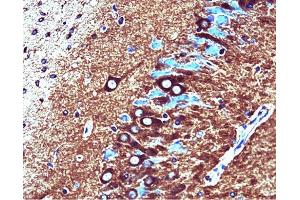 Catalytic alpha (clone 46) staining on rat brain. (PP2A Catalytic alpha (AA 153-309) antibody)